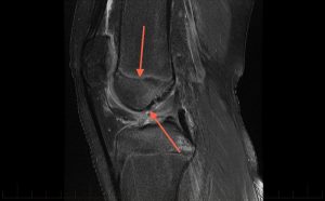  width=